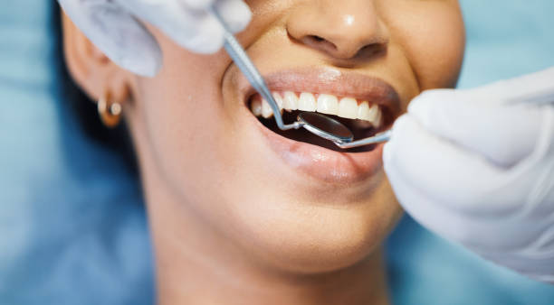 Best Emergency Tooth Extraction in Burnham, IL